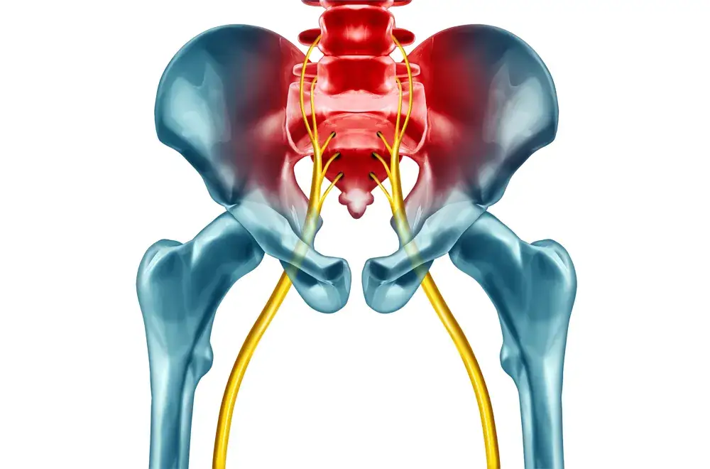 Jakie badania są potrzebne przy rwie kulszowej, aby uniknąć bólu?