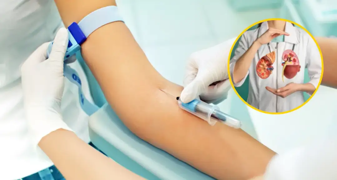 Podwyższony poziom mocznika - przyczyny i konsekwencje dla zdrowia