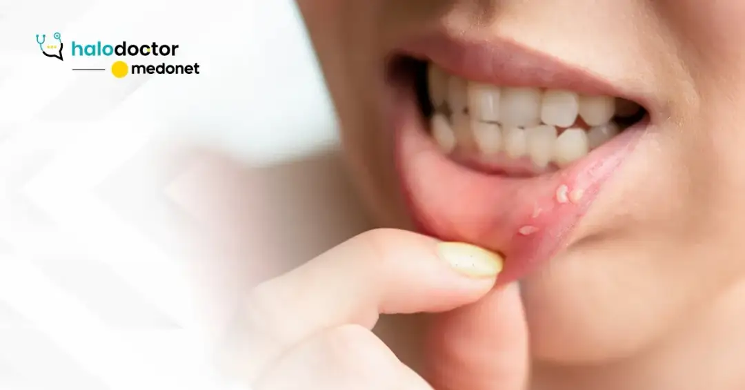 Choroby jamy ustnej: Do jakiego lekarza się udać?