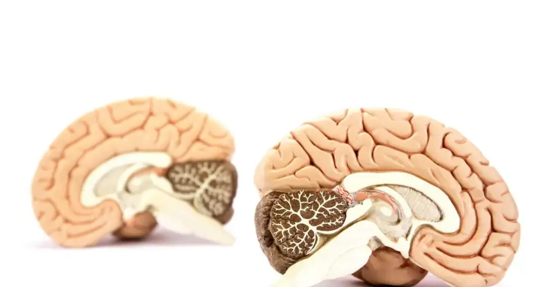 Zakręt Hipokampa: Co to jest i jak wpływa na funkcjonowanie mózgu?