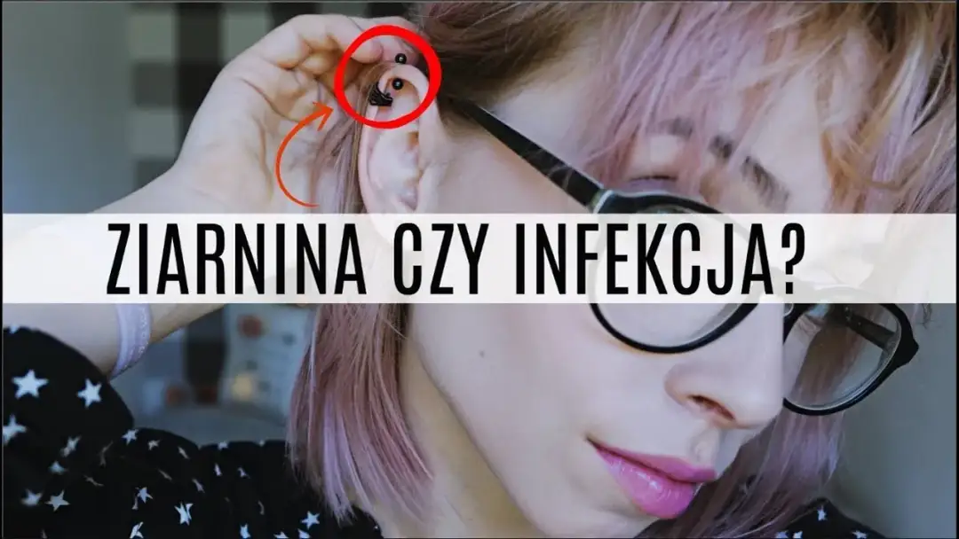 Jak leczyć infekcję po piercingu: skuteczne metody i porady