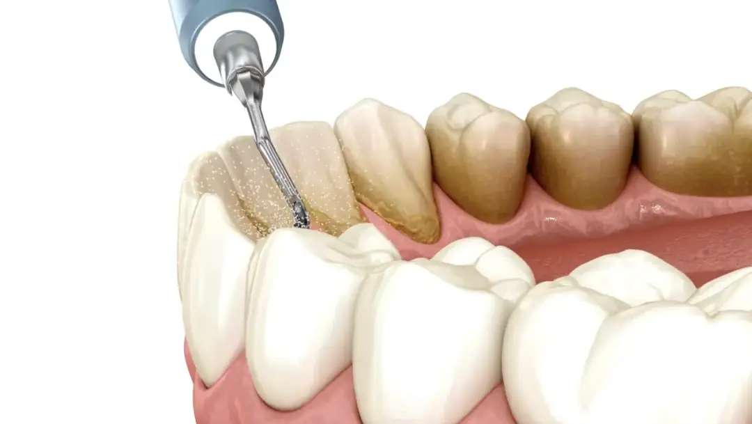 Dentysta: Poznaj pełen zakres pracy, specjalizacje i wpływ na zdrowie