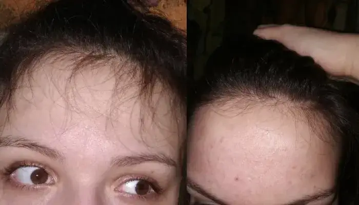 Wcierka Banfi Hajszesz - opinie i efekty długotrwałego stosowania