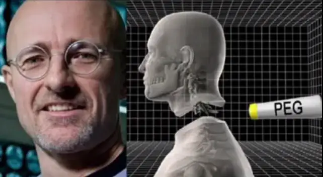 Pierwszy na świecie przeszczep głowy: kontrowersje i naukowe wyzwania