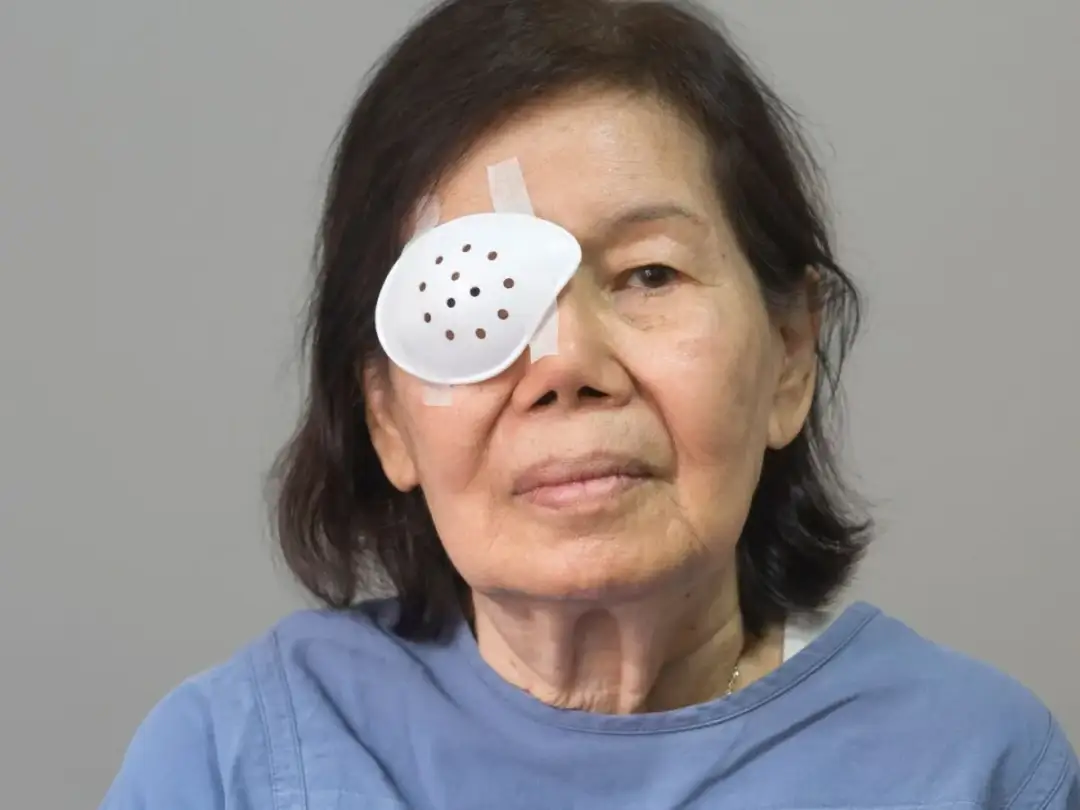 Czy można nosić stare okulary po operacji zaćmy? Sprawdź ryzyko!