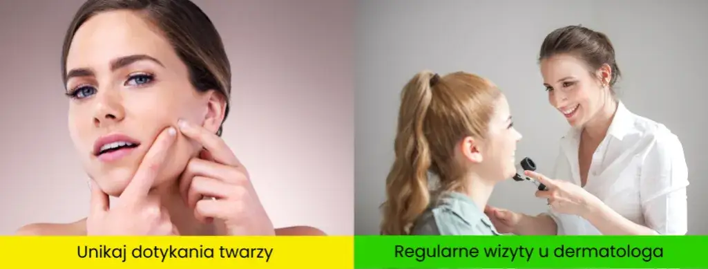 Skuteczne sposoby na pryszcze: Przewodnik po leczeniu i pielęgnacji