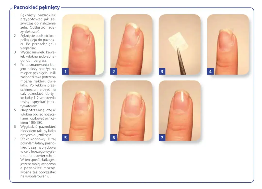 Jak zabezpieczyć pęknięty paznokieć i uniknąć dalszych uszkodzeń