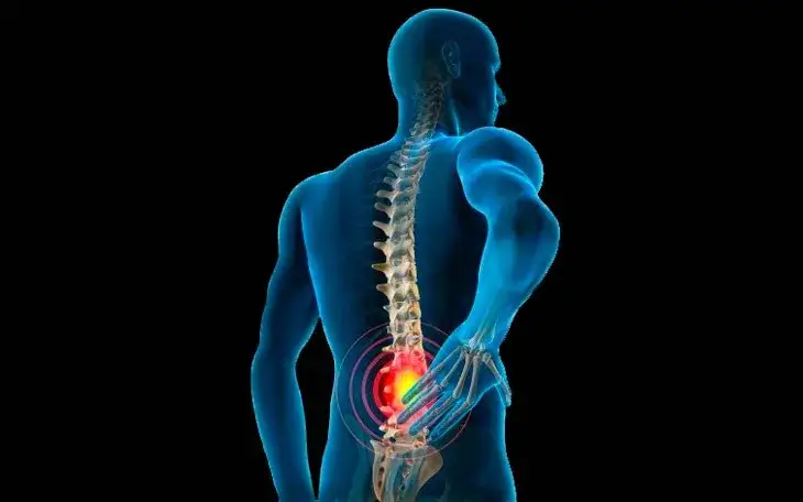 Todo sobre el músculo cuadrado lumbar: funciones, dolor y soluciones