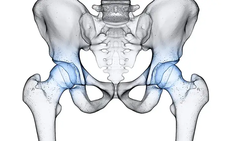 Endoproteza stawu biodrowego NFZ - gdzie najszybciej bez czekania