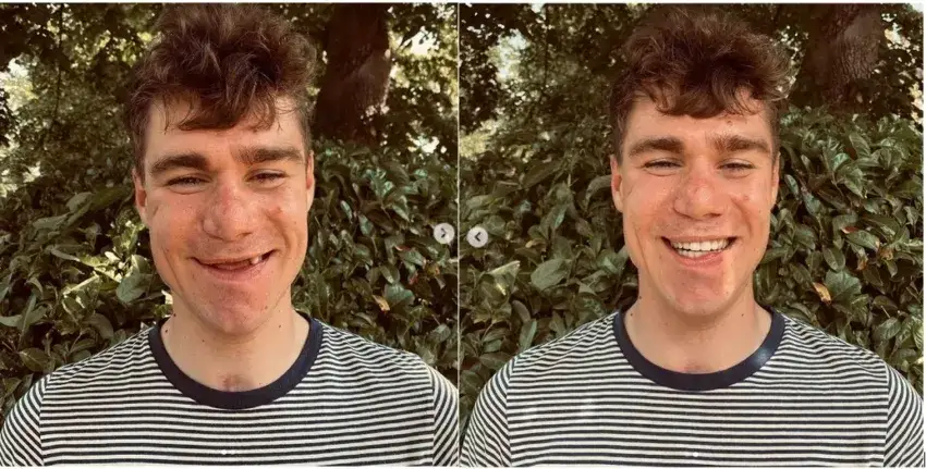 Fabio Jakobsen - fenomenalny powrót kolarza po tragicznym wypadku