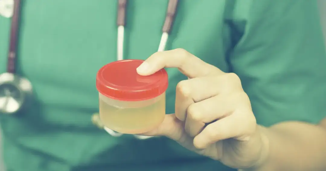 Uryna - co to jest i jaką rolę pełni w naszym organizmie?