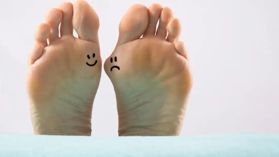 Jak sprawdzić czy mam haluksy i uniknąć bólu stóp