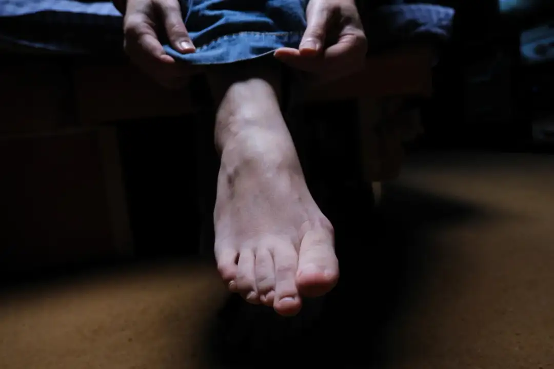 Test Czarne Stopy - Quiz i Badanie Online