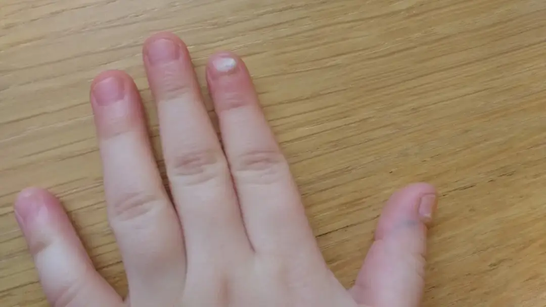 Czy po bostonce schodzą paznokcie? Zaskakujące skutki uboczne!