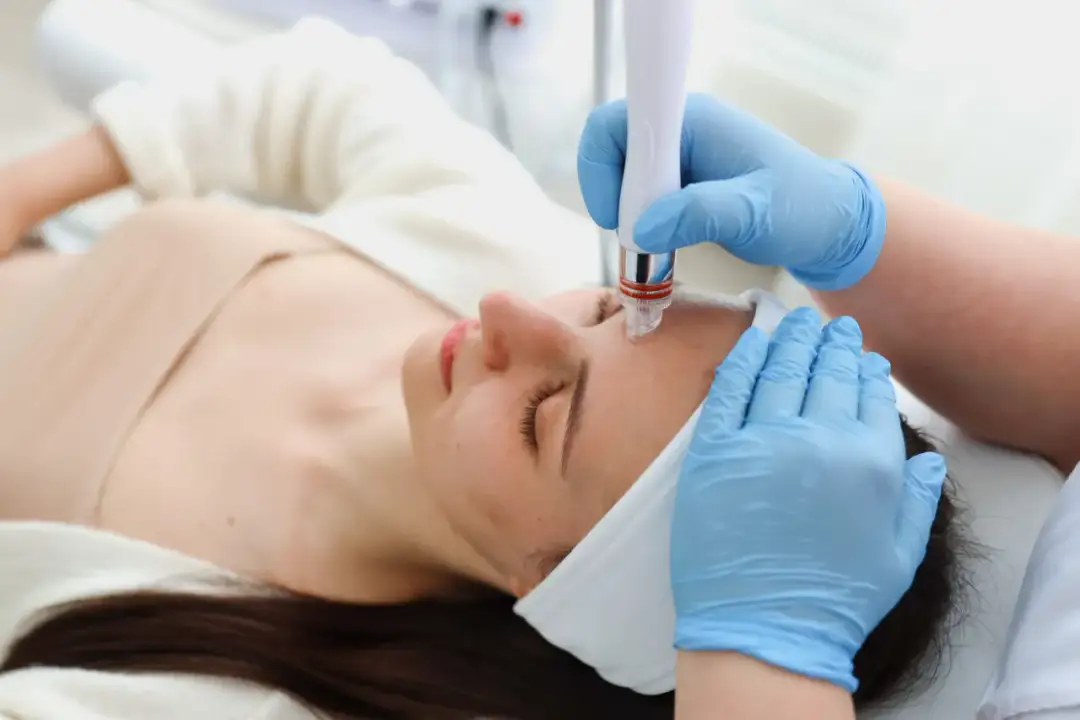 Oczyszczanie wodorowe czy mikrodermabrazja: co wybrać dla swojej skóry?