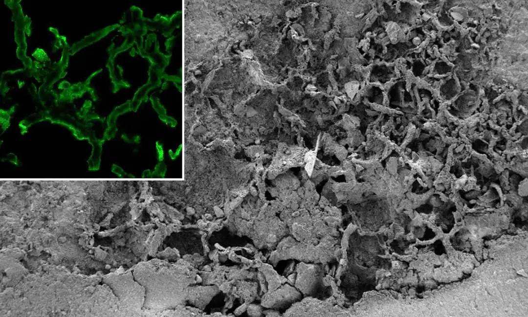 Fascynujący świat grzyba pod mikroskopem - poznaj tajemnice budowy grzybów