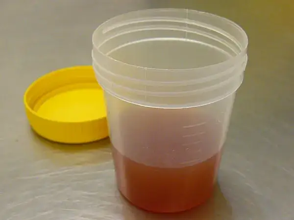 Ciemny mocz u psa: Przyczyny i co robić w takiej sytuacji?