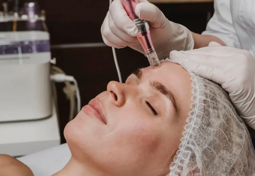 Co lepsze: dermapen czy laser frakcyjny - porównanie efektów i korzyści