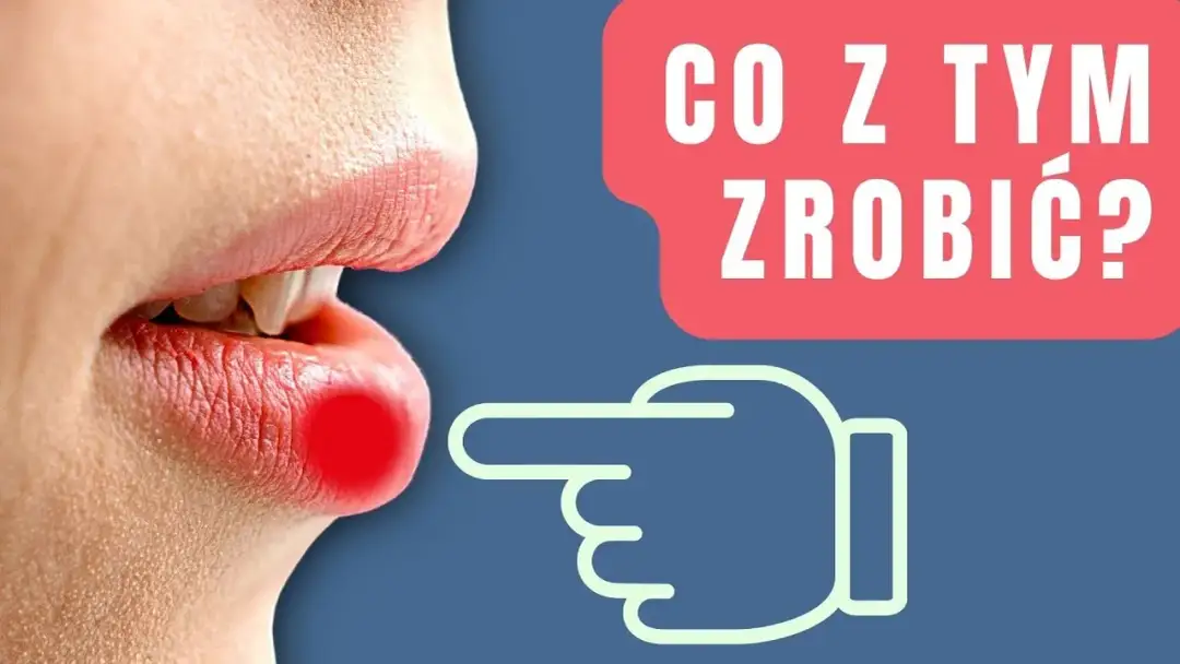 Opryszczka na ustach po makijażu permanentnym - skuteczne sposoby leczenia