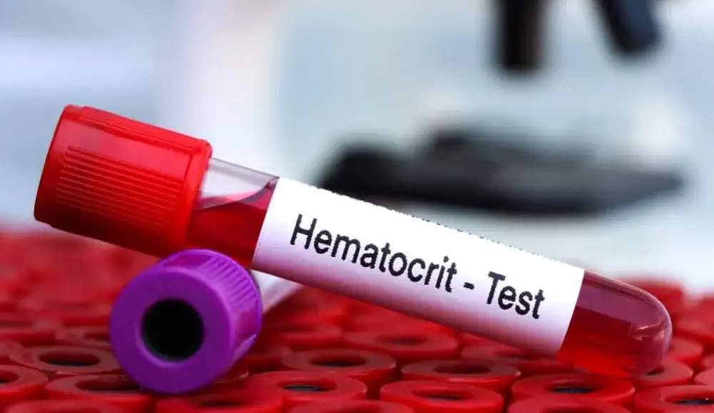 Wysoki hematokryt: Niebezpieczny znak dla kolarzy? Wyjaśniamy