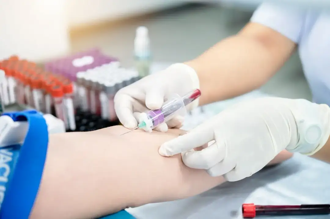 IgE całkowite – co to za badanie i jak interpretować wyniki?