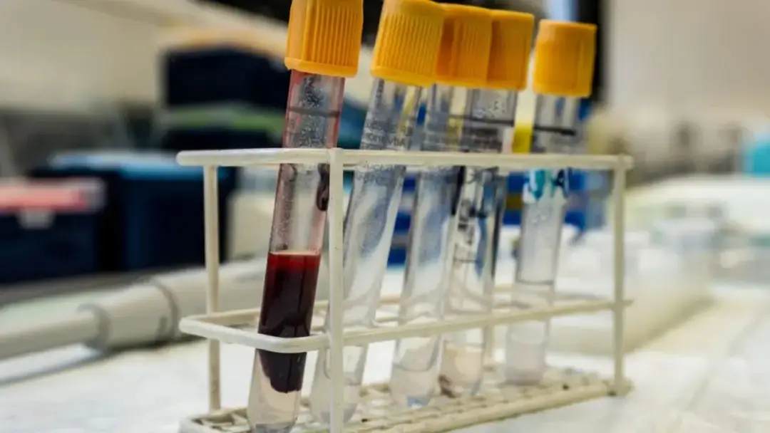 Jakie badania przed oddaniem krwi? Kluczowe testy dla bezpieczeństwa dawcy