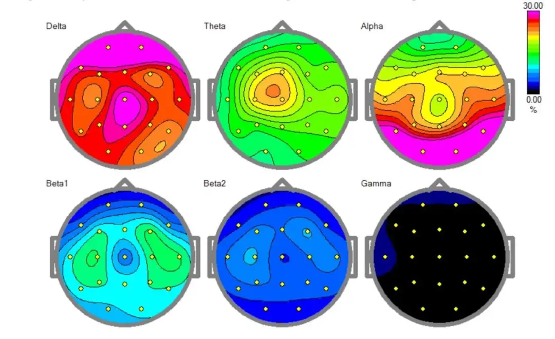 Co wykrywa badanie EEG głowy? Kluczowe informacje o diagnostyce neurologicznej