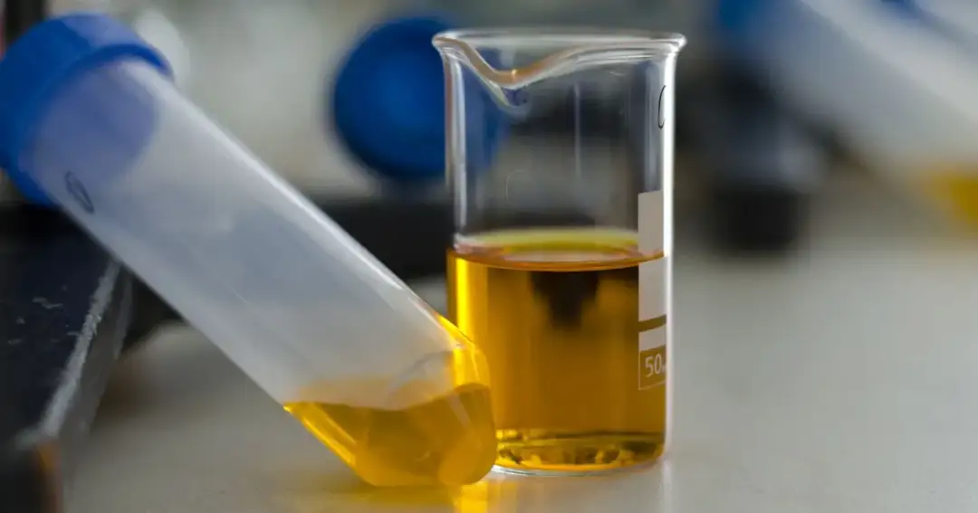 Jak przechowywać mocz przed oddaniem do laboratorium, by uniknąć błędów?