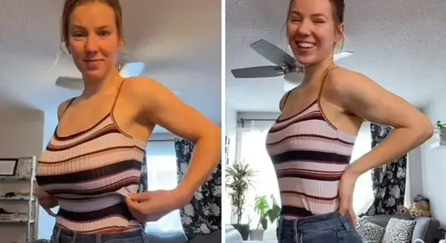 Operacja zmniejszenia biustu NFZ gdzie? Sprawdź, jak uniknąć bólu i kosztów