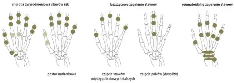 Jakie badania na oddziale reumatologii? Poznaj kluczowe testy diagnostyczne