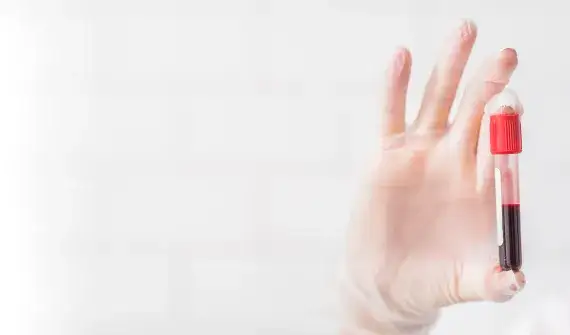 Co oznacza PLT w badaniu krwi i jakie może mieć konsekwencje?