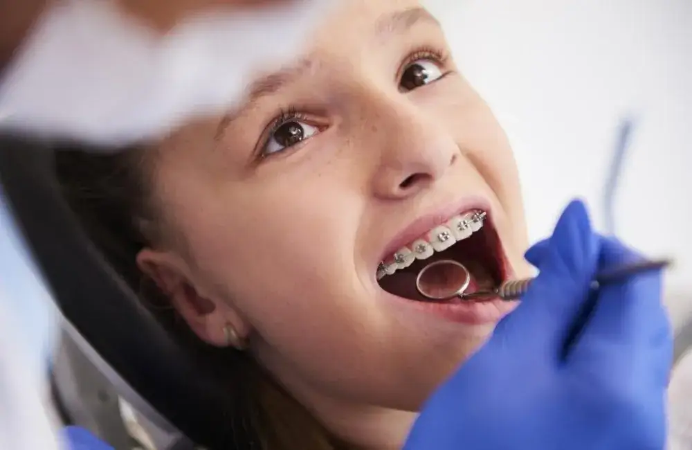 Ortodonta czy dentysta? Kto założy aparat na zęby?