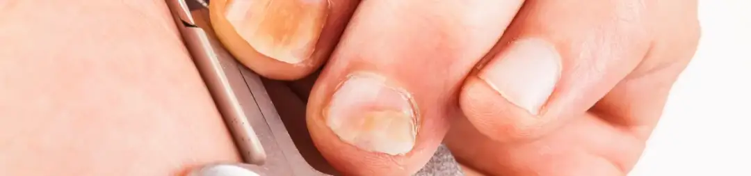 Jakie są nazwy lekarzy od paznokci u rąk i kiedy ich potrzebujesz?