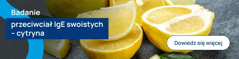 Czy cytryna uczula? Objawy alergii, których musisz się wystrzegać