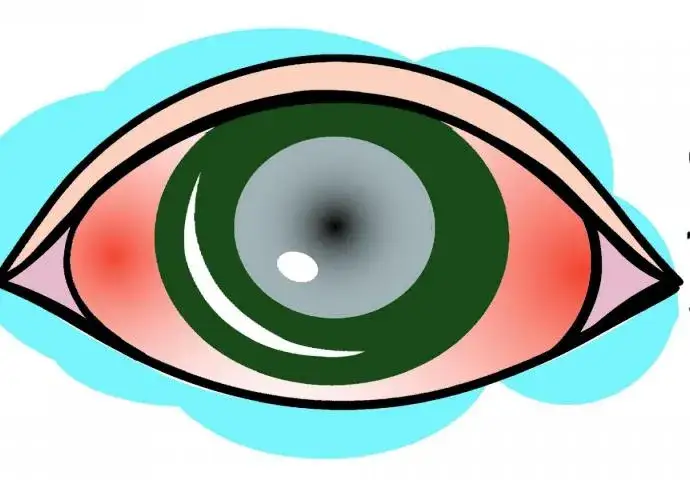 Czego nie wolno robić przy jaskrze, aby uniknąć poważnych problemów