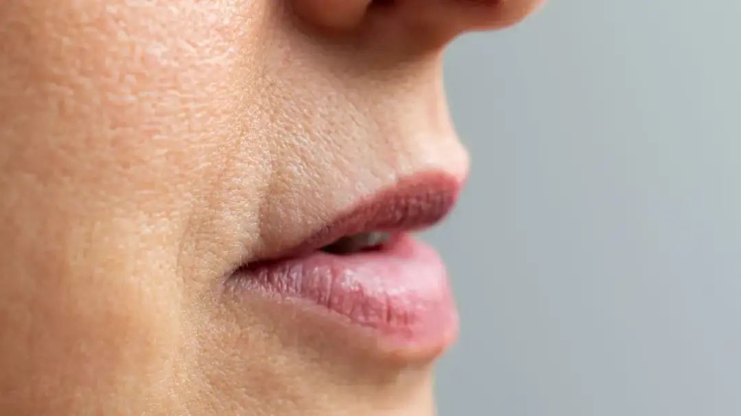 Jak usunąć kwas hialuronowy z ust domowe sposoby, które nie działają