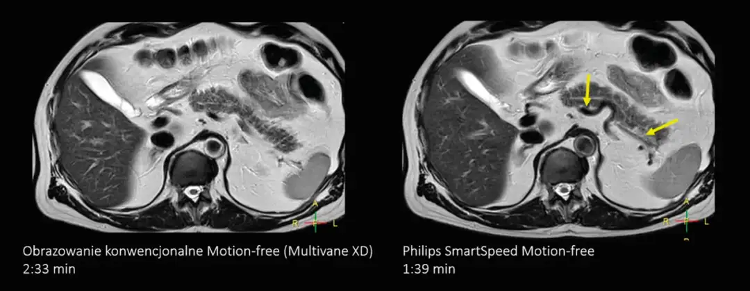 Rezonans: Niewidzialna siła, która buduje i niszczy świat