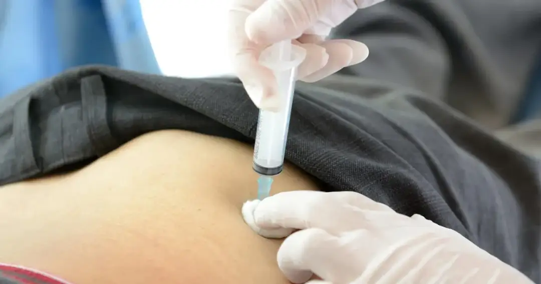 Które zastrzyki przeciwbólowe działają najskuteczniej? Oto nazwy