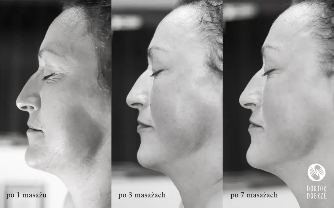 Masaż Kobido: Naturalny lifting twarzy? Poznaj efekty i etapy