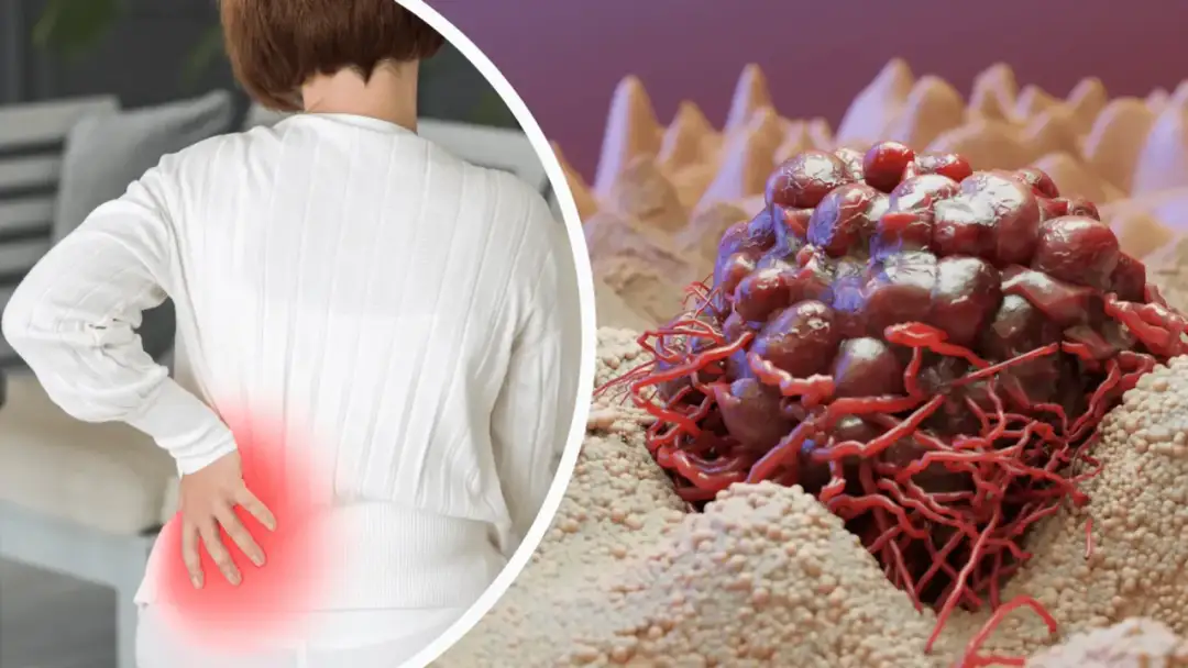 Zwolnienie na kręgosłup (L4) - Jak załatwić L4 na kręgosłup