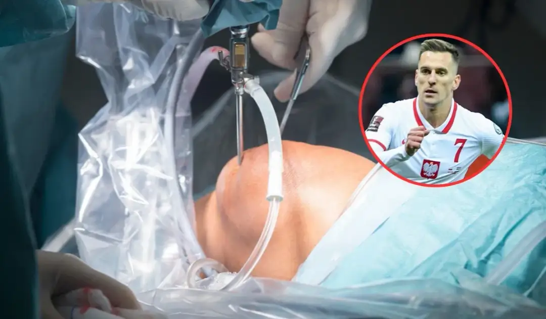 Najszybsza artroskopia kolana NFZ – terminy i dostępność w Polsce