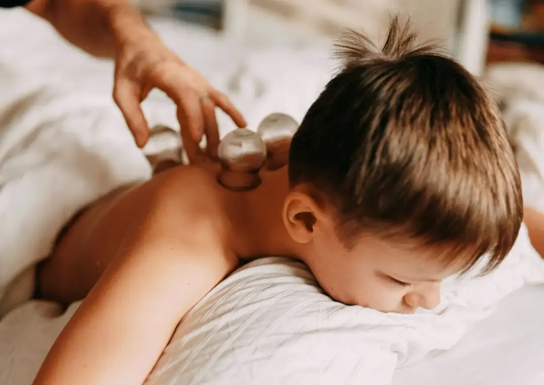 Stawianie baniek u dzieci - częstotliwość i bezpieczne odstępy