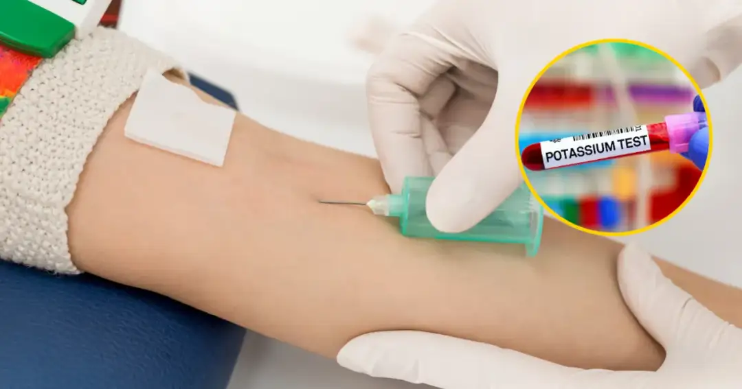 Wysoki potas u niemowlaka: Objawy, przyczyny i jak obniżyć? Wysoki potas u niemowlaka: Objawy, przyczyny i jak obniżyć?