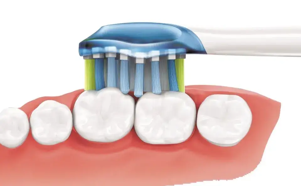 Co wzmacnia zęby i dziąsła? Poznaj skuteczne sposoby na zdrowie jamy ustnej