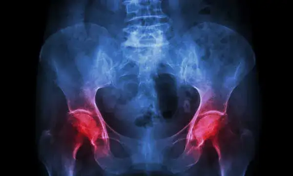 Skutki uboczne Bonviva: co musisz wiedzieć, aby uniknąć ryzyka