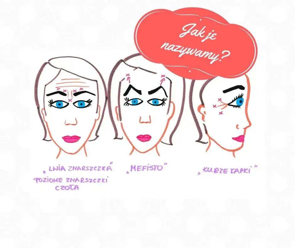 Ile jednostek botoksu na kurze łapki? Sprawdź, co musisz wiedzieć