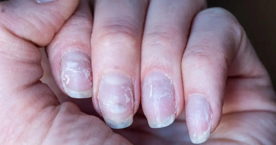 Manicure japoński: kiedy najlepiej zrobić po hybrydzie dla zdrowia paznokci