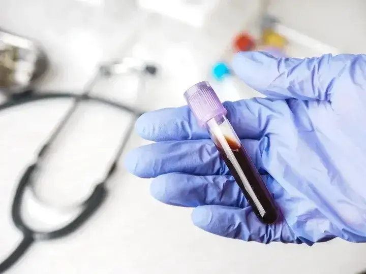 Co jeść przed badaniem krwi, aby uniknąć błędnych wyników?