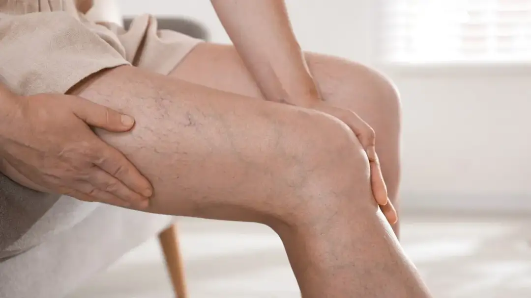 Moje nogi: 7 niepokojących objawów których nie możesz ignorować