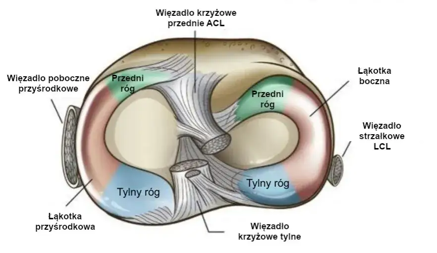Pozioma szczelina łąkotki przyśrodkowej: Jak leczyć? Porady